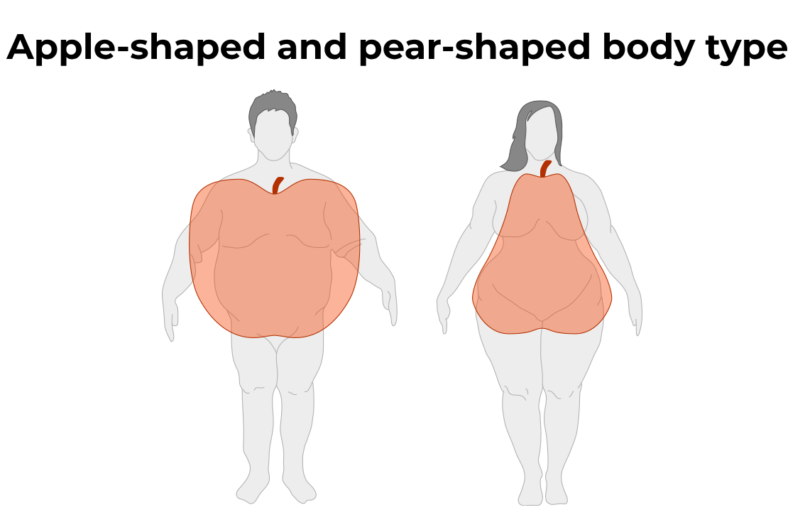 Ανδροειδής έναντι Γυναικοειδούς παχυσαρκίας